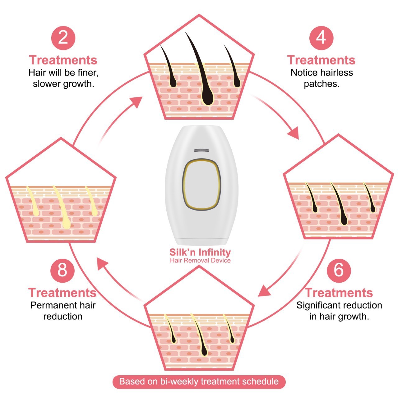 Home Use Laser Hair Removal Device